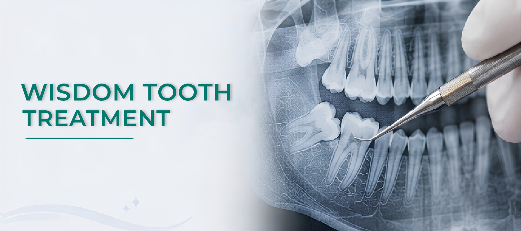 Wisdom Tooth Treatment hero banner
