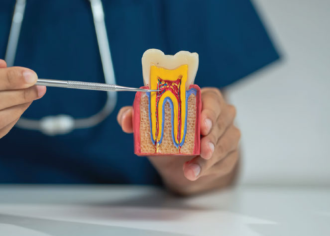 Root canal treatment